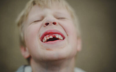 How to treat baby tooth problems and injuries