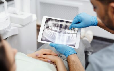 Dental Checkups- 5 Reasons Why You Shouldn’t Skip